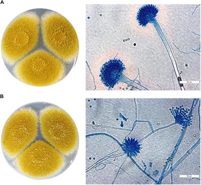 Characterization of Aspergillus tamarii Strains From Human Keratomycoses: Molecular Identification, Antifungal Susceptibility Patterns and Cyclopiazonic Acid Producing Abilities